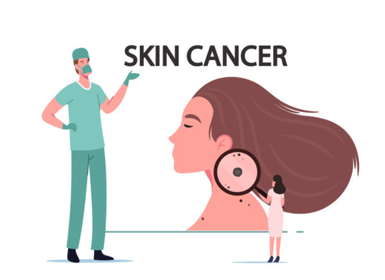 피부암 초기증상 클럽아트 코리아