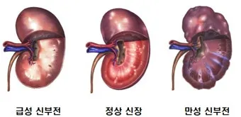 강아지 신부전에 좋은 음식 추천_3