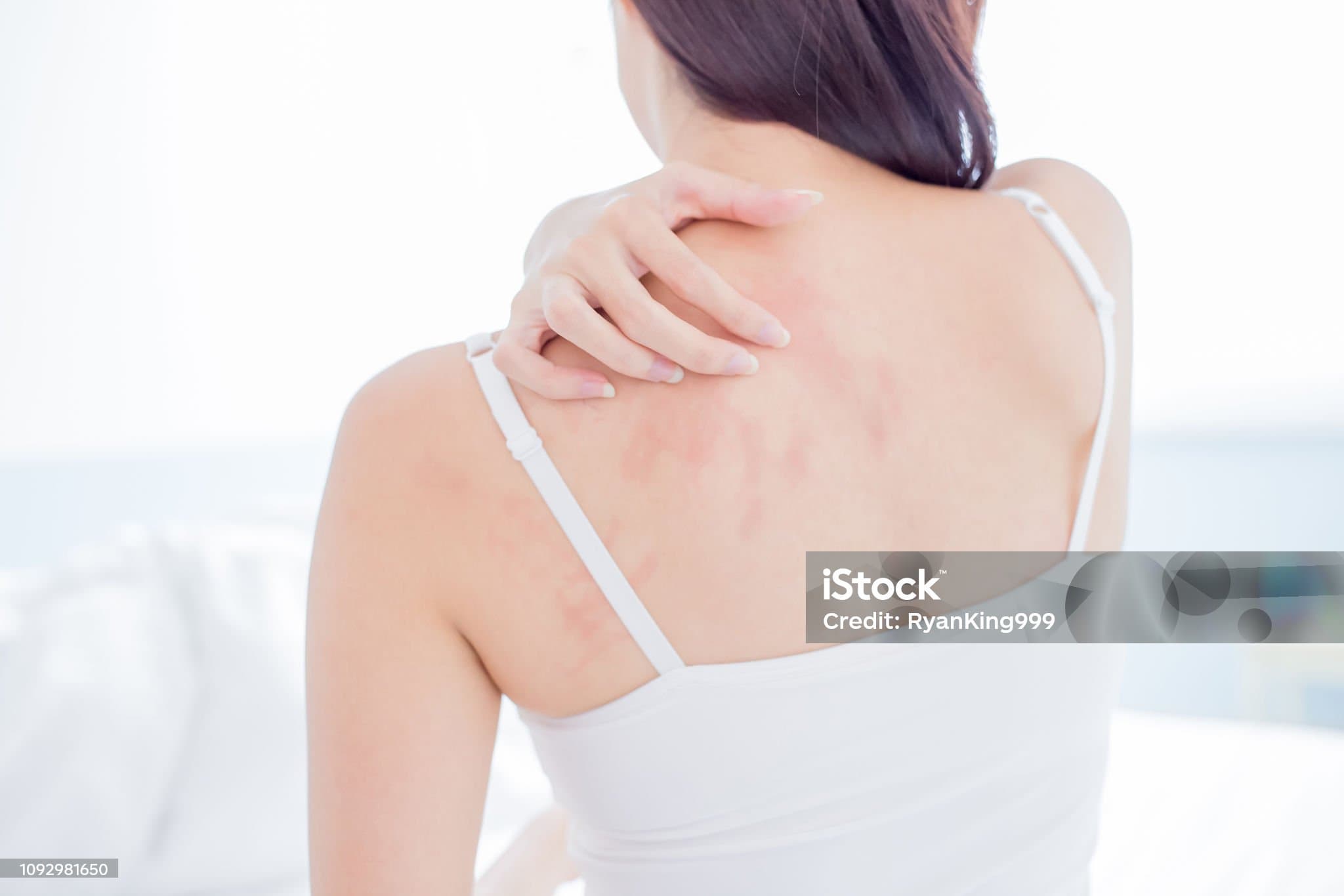 몸이 간지러운 이유&amp;#44; 헷갈리는 알레르기 vs 질환 차이