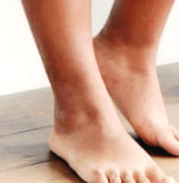 복숭아뼈 주위가 부어요, 단순한 부음일까? 물혹일까?