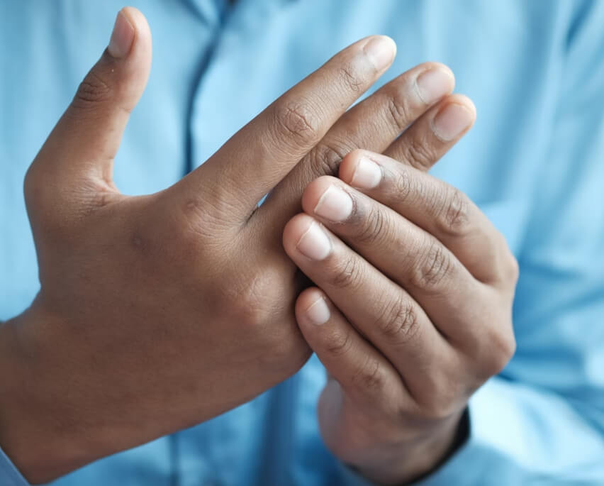 류마티스 관절염 초기증상