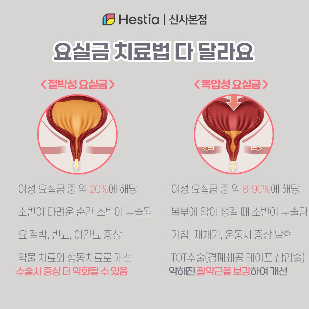 요실금 치료법 다 달라요