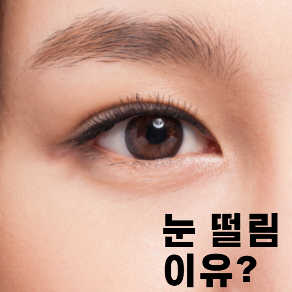 눈떨림 이유 : 눈 떨림현상