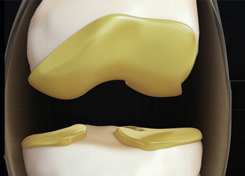 콘드로이친 1200mg 가격 비교로 해결