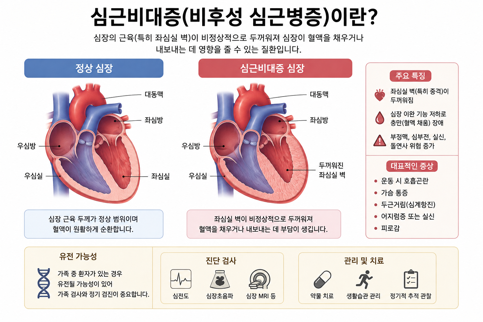 심근비대증, 심장 근육이 두꺼워지면 어떻게 될까?
