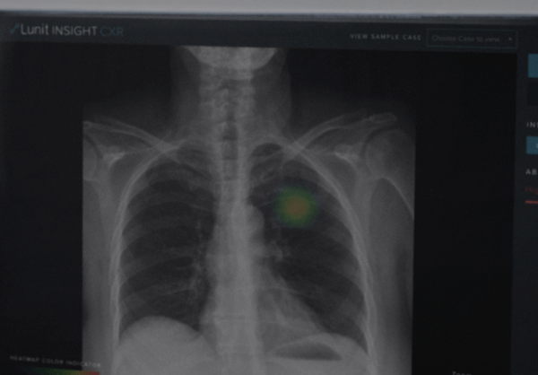 루닛-시스템-화면