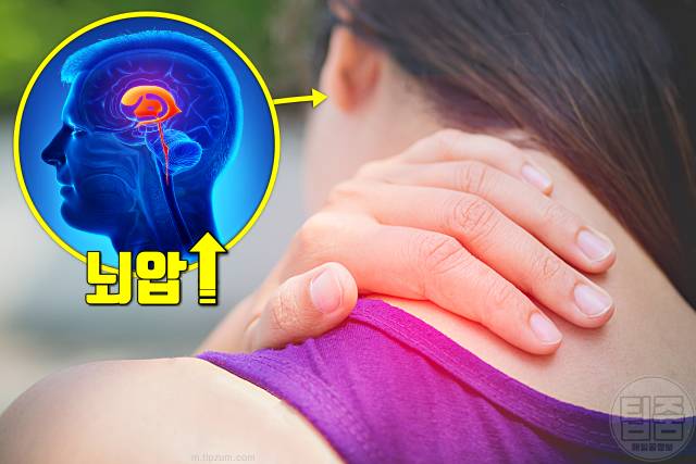일본뇌염 증상 후유증 치사율 예방접종 가격 목통증