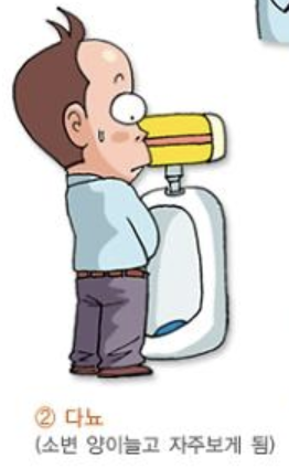 당뇨병 초기증상 2