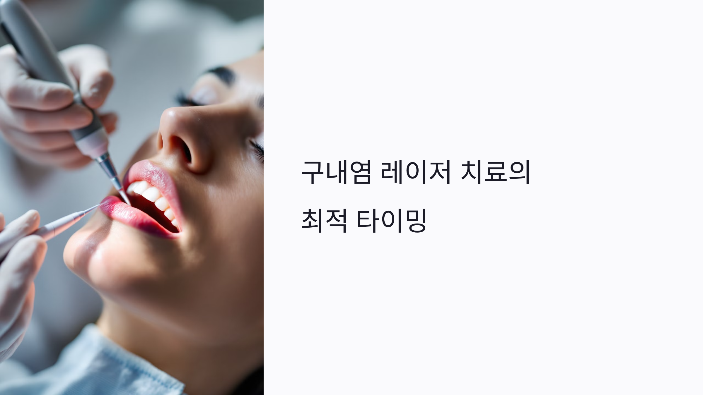 구내염 레이저 치료 언제 해야 할까? 초기 vs 진행 상태별 효과와 회복 속도