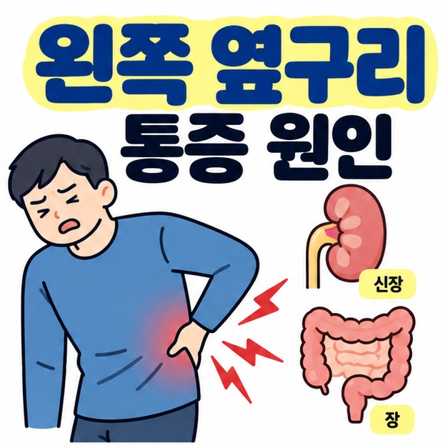 왼쪽 옆구리 통증 원인 문구와 왼쪽 옆구리를 짚은 인체 실루엣, 신장과 장 아이콘을 보여주는 대표 카드