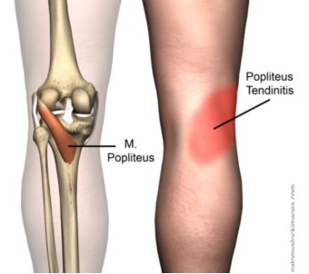 popliteus