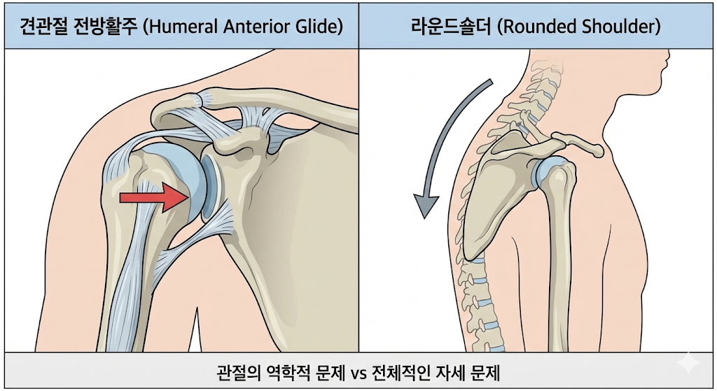 견관절 전방활주와 라운드숄더 차이