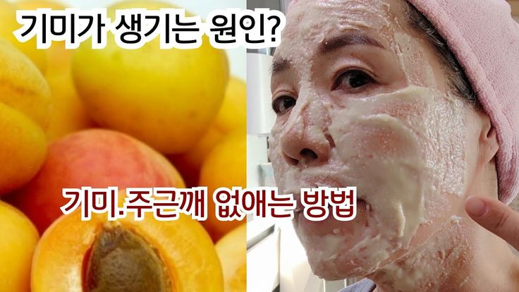 기미, 주근깨 없애는 방법
