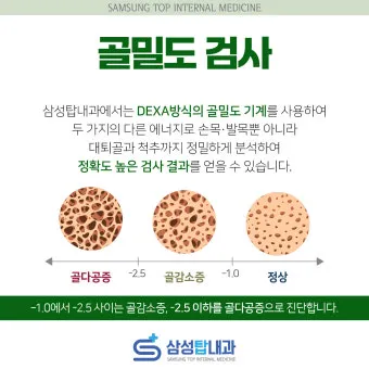 골밀도 검사 수치 골밀도 높이는 방법 간단 정리_2