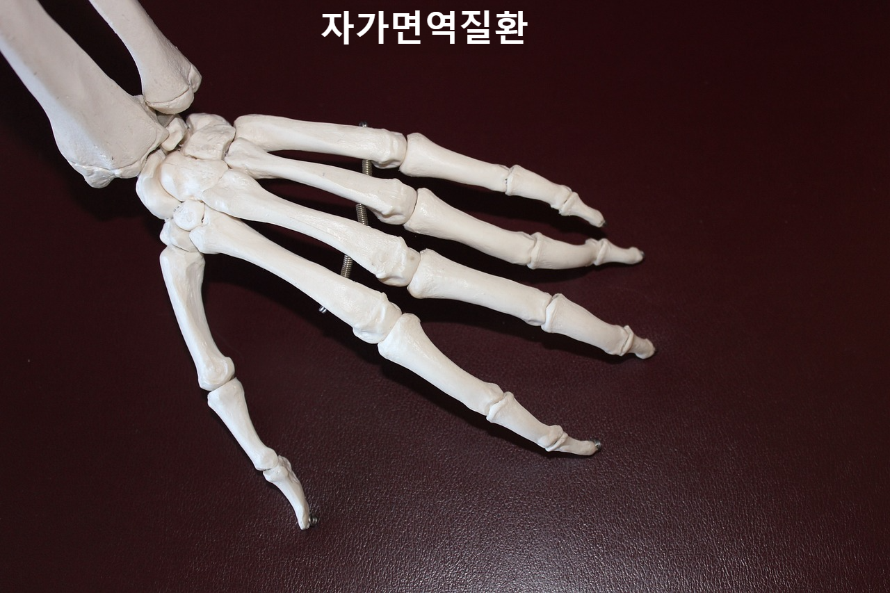 자가면역질환