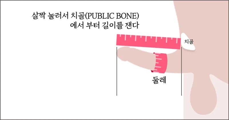 배를 눌러 치골에서부터 음경 끝부분까지 측정