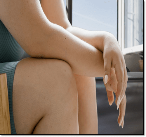 셀룰라이트가 생기기 쉬운 비만 여성