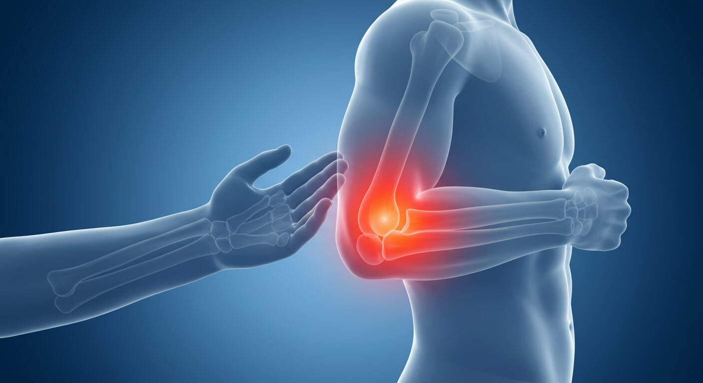 남자의 엘보에 발갛게 보이고 있는 삽화