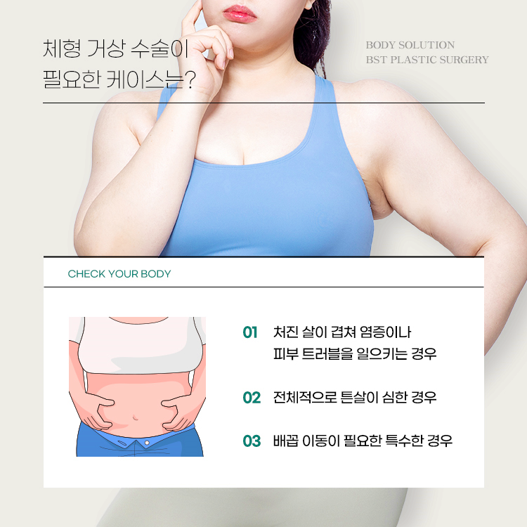 체형거상수술이 필요한 케이스는?
1. 처진살이 겹쳐 염증이나 피부 트러블을 일으키는 경우
2. 전체적으로 튼살이 심한 경우
3. 배꼽 이동이 필요한 특수한 경우