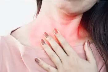 역류성 식도염 원인 및 증상, 치료법