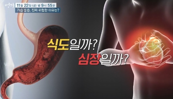 식도일까심장일까