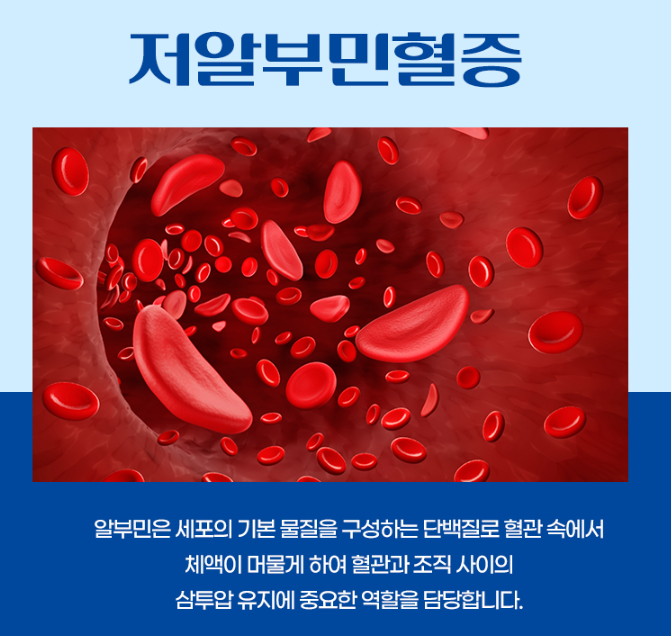 저알부민혈증