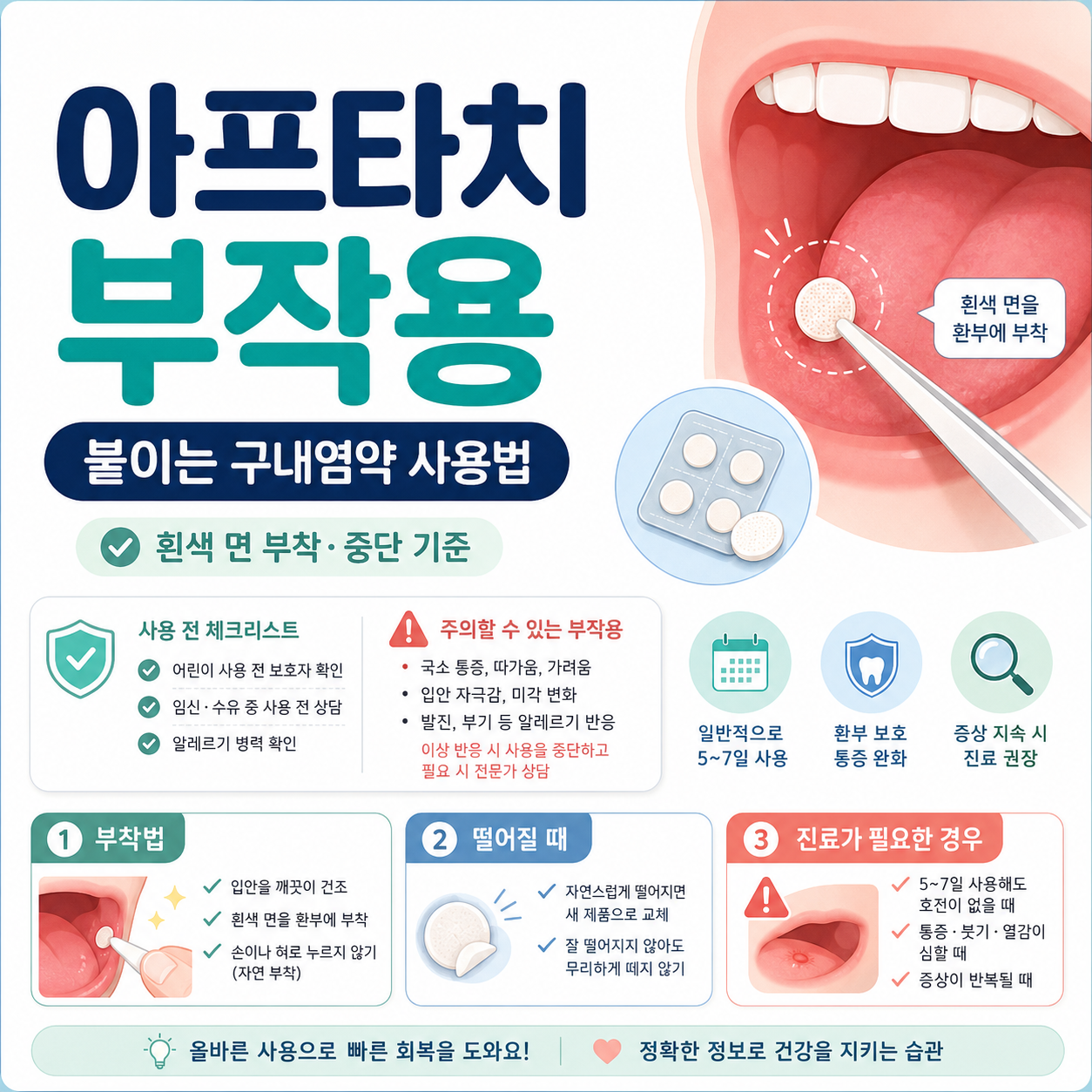 아프타치 흰색 면 부착법, 구내염 위치, 떨어짐과 이상 증상, 진료 기준을 확인하는 카드형 이미지