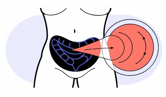 췌장암 원인과 의심증상