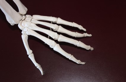 류마티스 관절염 초기 증상