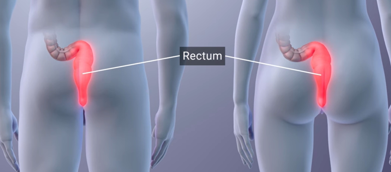 클라미디아 감염 경로