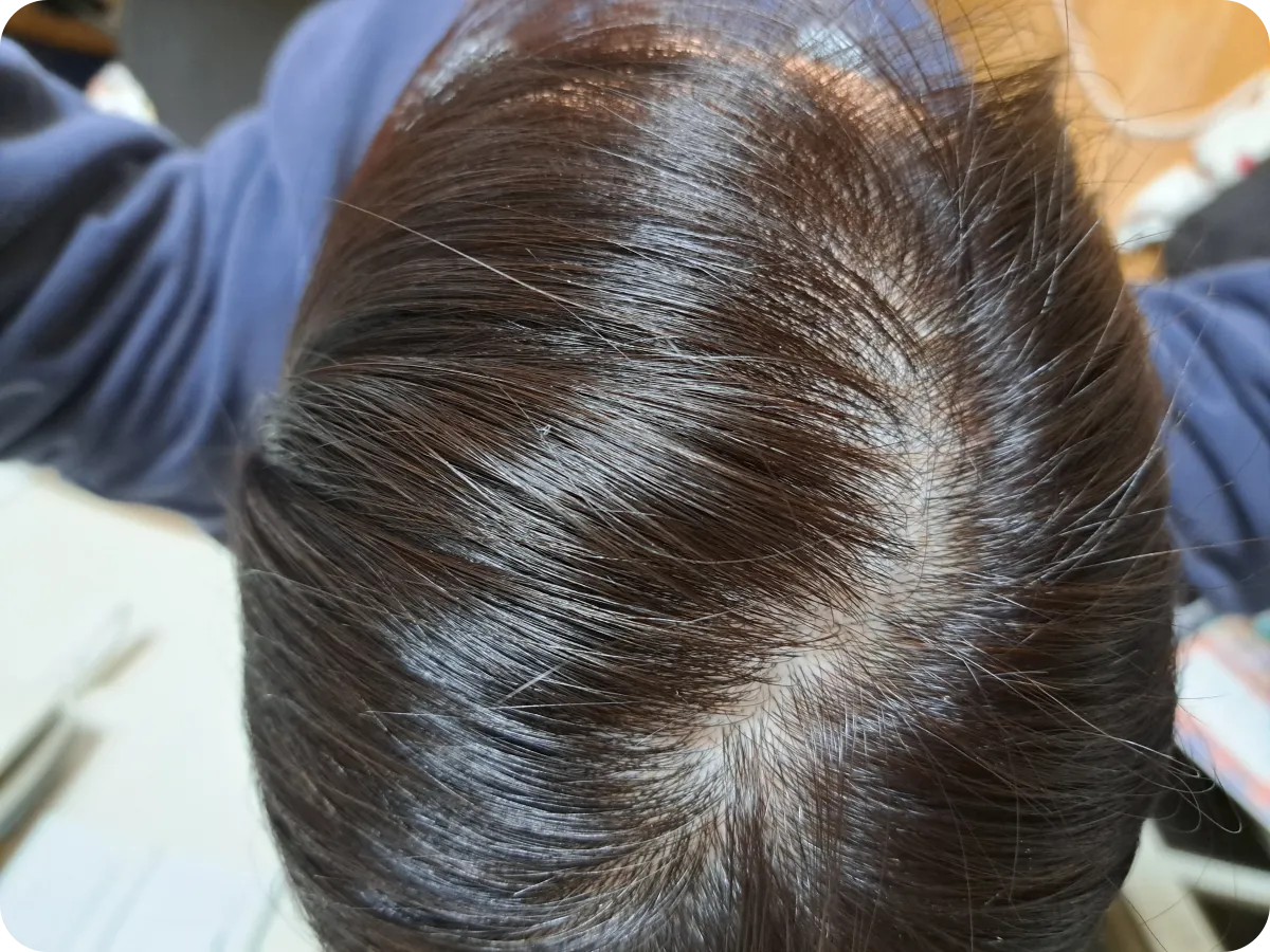 셀프염색-두피보호제-데미프로텍터크림-후기-두피상태