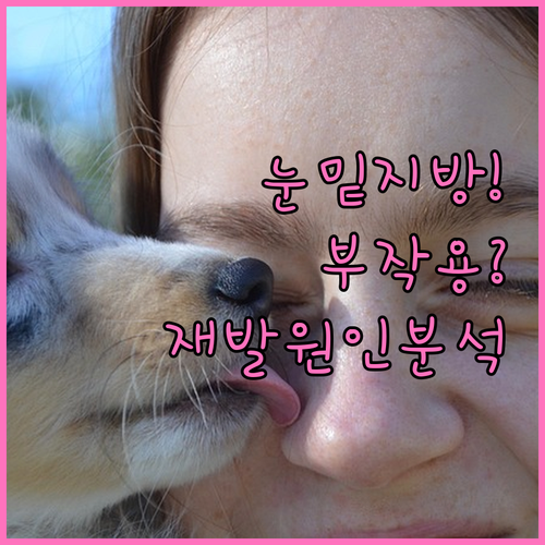 눈밑지방재배치 부작용과 재발 원인 분..