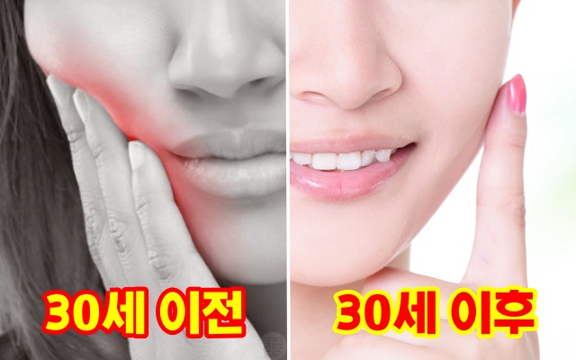 30대 치아 감수성 충치, 건강 팁줌 매일꿀정보