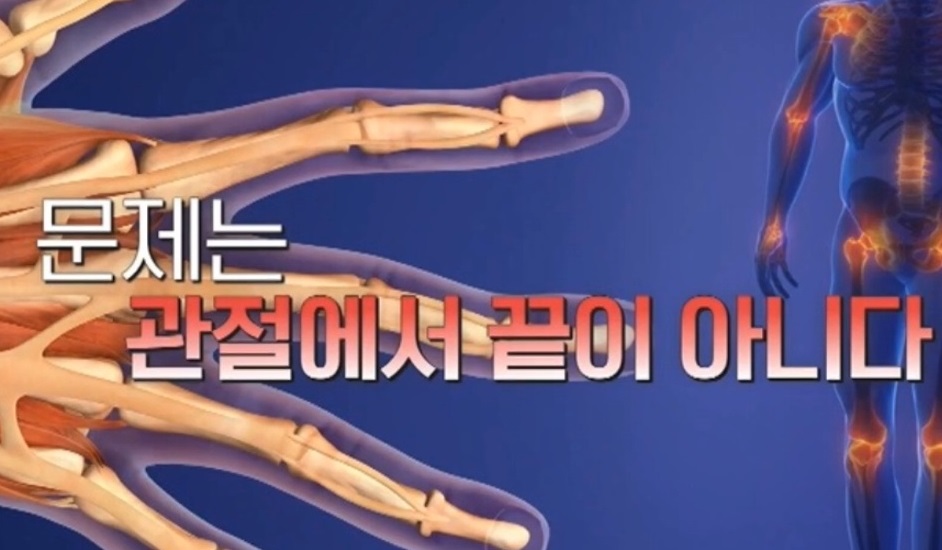 EBS명의-류마티스-관절염