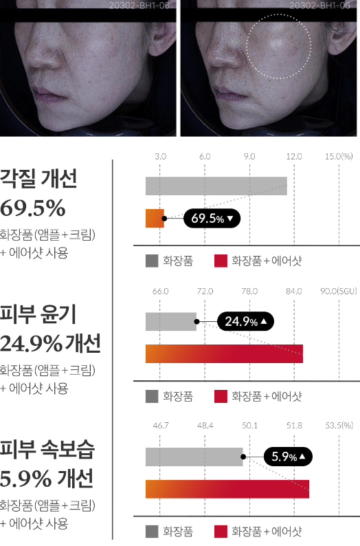1회 사용으로 인한 피부 탄력 변화