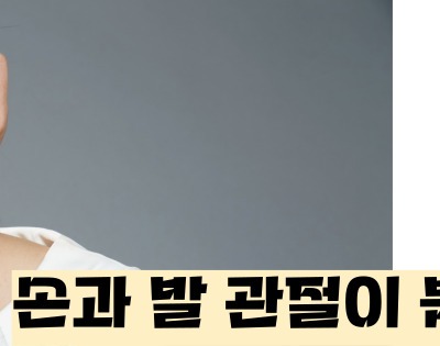 류마티스 관절염 초기증상