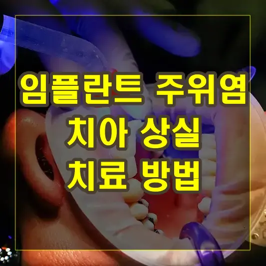 임플란트 주위염 치아 상실 치료 방법