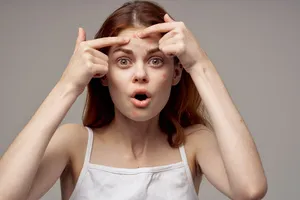 좁쌀여드름-없애는법