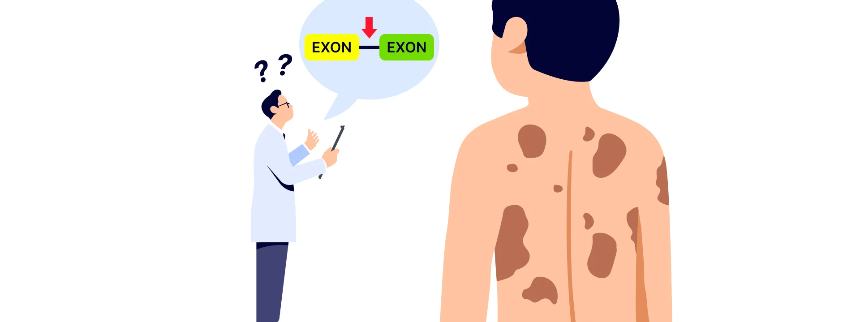 신경섬유종 초기 증상, 혹시 나도? 놓치면 안 되는 신호