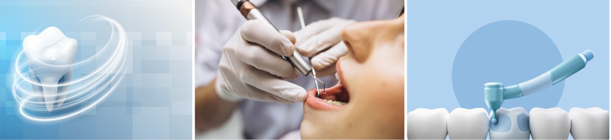 임플란트 보험 비교 추천