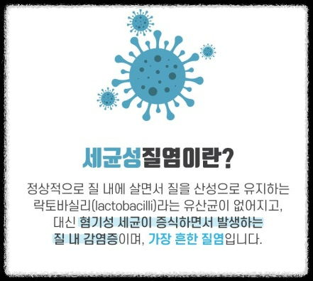 세균성 질염의 모든것