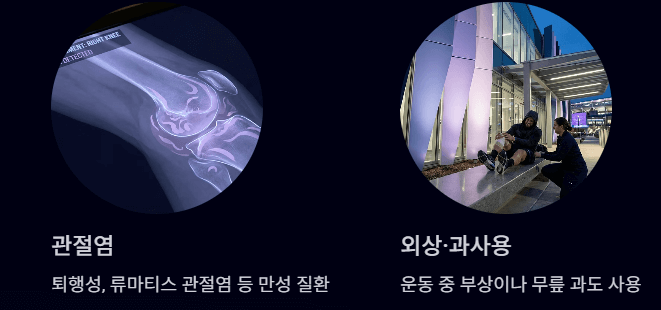 무릎에 물이 차는 증상