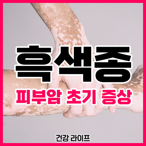 흑색종