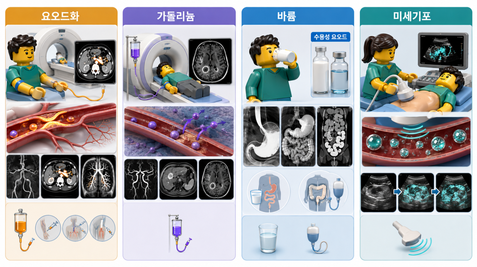 CT·X-ray·MRI·위장관 검사와 조영증강 초음파에서 사용하는 조영제 종류 비교