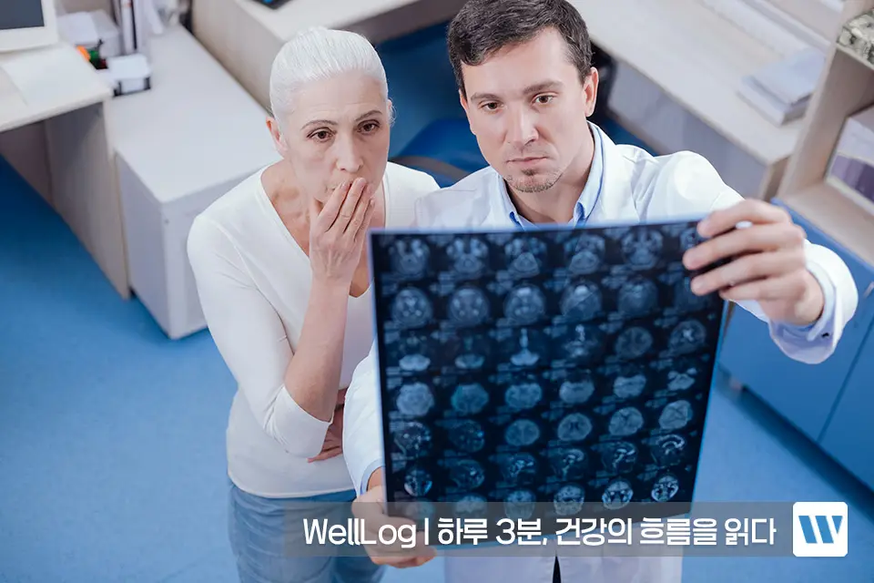 포스파티딜세린 효능 효과