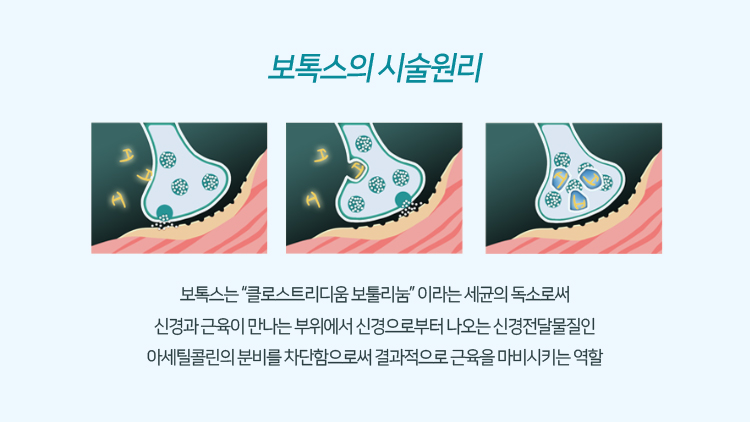 보톡스 원리