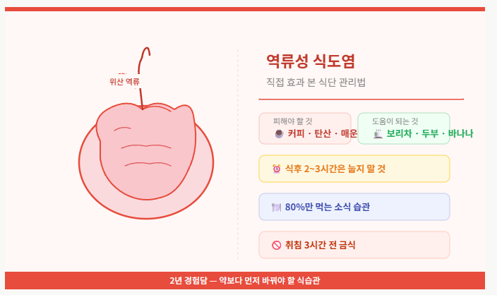 역류성 식도염