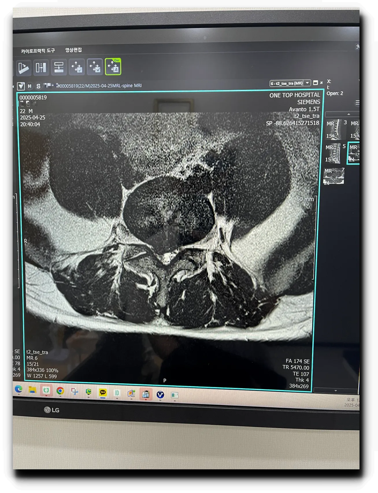 4월-25일-MRI-사진-단면
