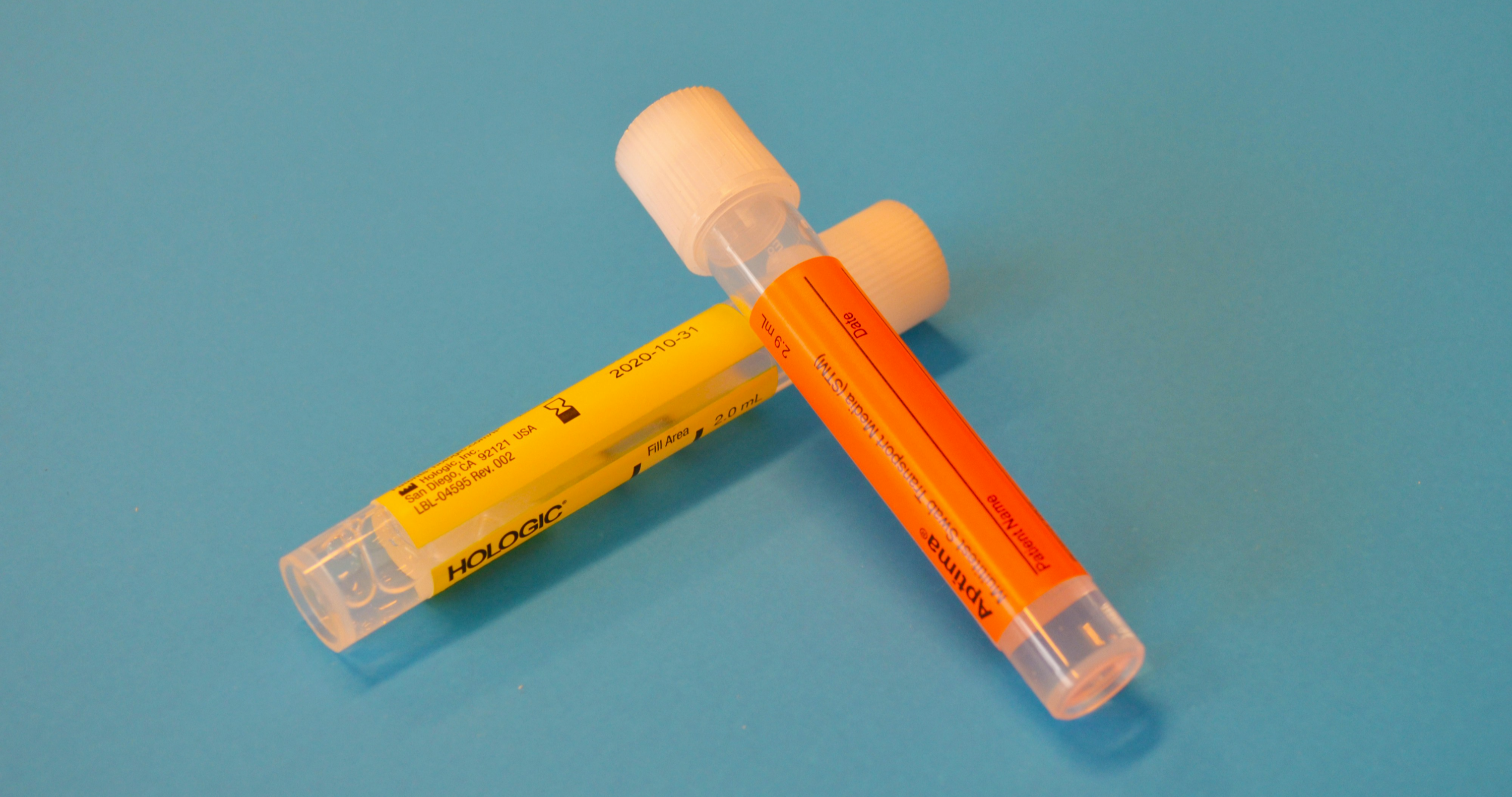 소변을 수집하는 튜브