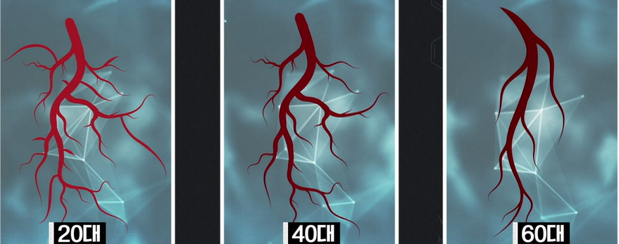 포스파티딜세린 효능